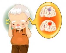 <b>帕金森病的诊断标准有哪些？</b>